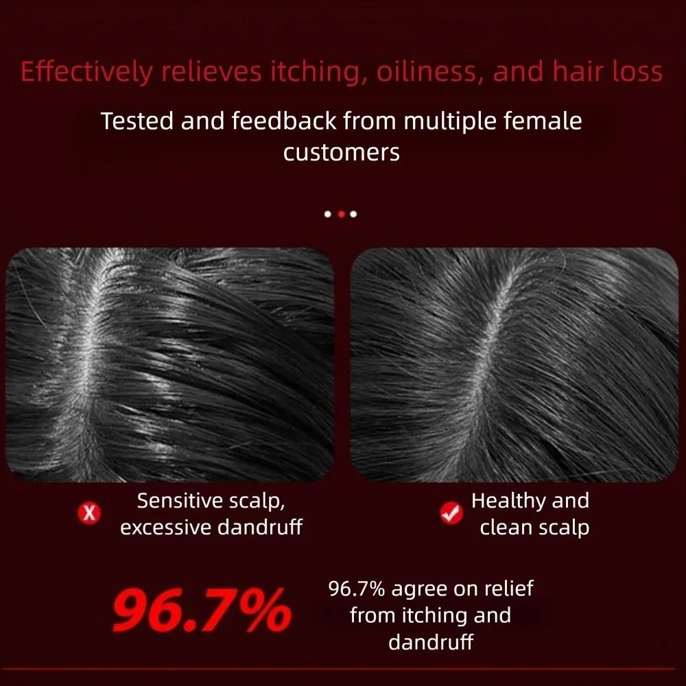 Folisure Hair Massager