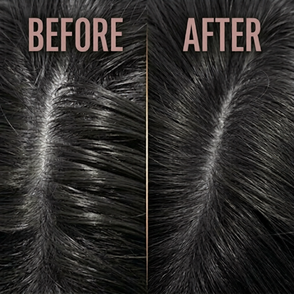 Folisure Hair Growth Massager